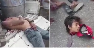 One Hell of a Head Popping Work Accident