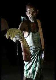 Dude Chopped Off Giant Woman's Arm