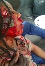 WTMF Is Wrong with this African Bitch?