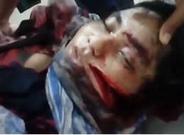 Woman Given a Joker Smile for Not Accepting Marriage Proposal 