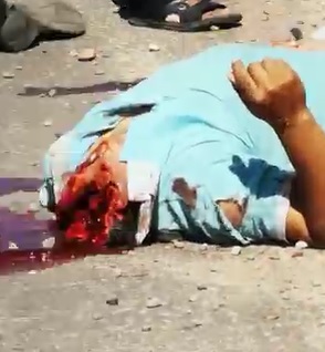 Don't Think he's Going to Make it....