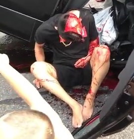 Dude Scalped in Accident