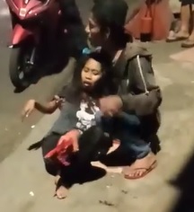 Woman Left Legless from Train Accident