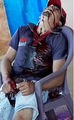 Bar Chair Murder Scene 