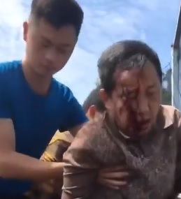 Hitting a Fence ... Looks Like Dudes Face is Melting Off