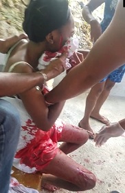 Cute Girl Sliced up with Knife.