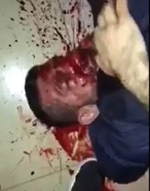 MMA Fighter Rasul Mirzaev Severely Beaten in Street Fight