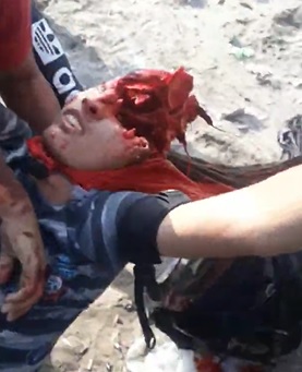 Protesters Don't Do So Well in Other Countries.