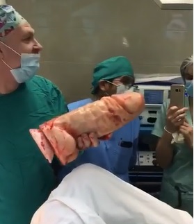 WTMF: Monster Dildo Removed from Ass (Another Angle)