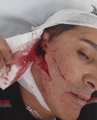 Dudes Ear Ripped Off