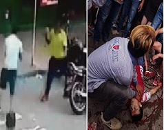 Damn Dude Stabbed Right in an Artery 