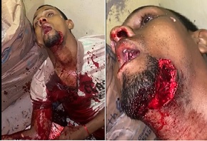 Shot 30 Times Including one on the Chin