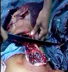 The Gourmet Beheading..