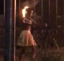 DAMN: Shocked Girl on Fire from Accident (Skin Hanging Off)