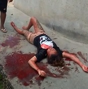 Dying Hot Girl on the Street