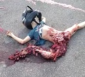 Damn Bro, Just Walk it Off....