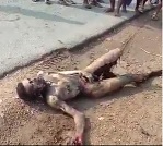 Moron Sets Himself on Fire....Now, He Regrets It.