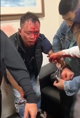 Dude Beaten with a Hammer over $2000 Debt.