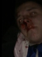 This Poor Kid Was SAVAGELY Beaten