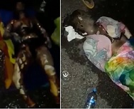 Poor Woman Still Alive After Burning Car Wreck.