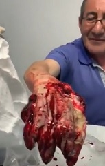 Can't Jerk Off with that Hand Anymore.