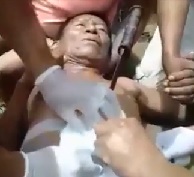 Machete Embedded In Man's Heart.