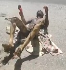 Moronic Kid Tries Self-Immolation... Regrets It.