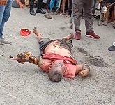 Bad Day at Work... Touches Live Wire Burns his Arm Off..Dies on Street