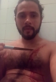 Attention Seeker Cuts Himself on FB Live.