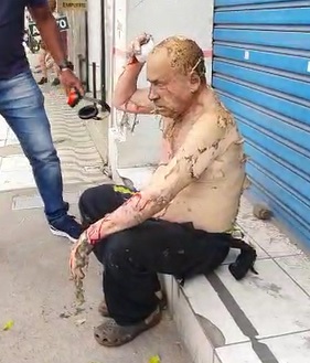 Grenade explodes , The Armory , Owner Burned