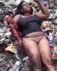 Half Naked Woman with severly lacerated arm from Accident.