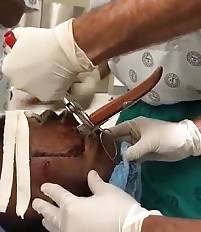 Lucky Enough to Get to a Doctor.