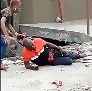 Protester Losing Guts After Police Bullet.