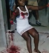 DAMN: Woman's Arm Removed with a Machete.