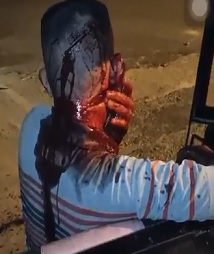 Dude Sliced TF up with Machete (Hospital Scene too)