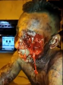 WTMF Happed To this Guy?