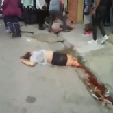 Woman Loses Both Legs in Accident (More Footage)