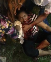 Lady Stabbed and Bleeding Out.