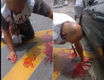 Man Stabbed In Face Got Knife Stuck