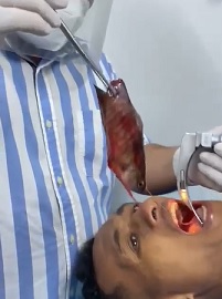 WTFFFF: Live Fish in His Mouth.