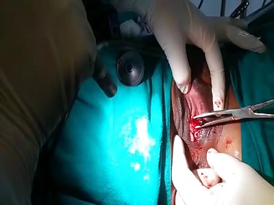 Ball pen inside vagina (Gross) 