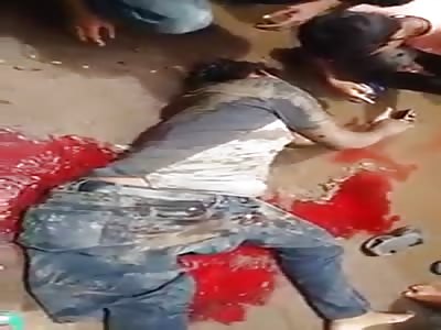 DUDE FUCKED UP FROM ACCIDENT TEXTS FOR HELP SINCE NOBODY ELSE WILL