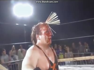 czw head pain
