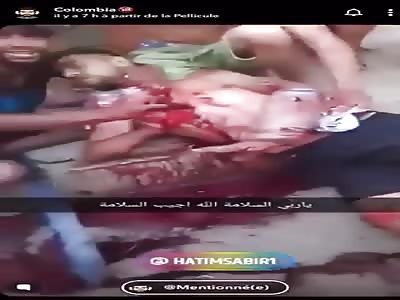 Machete Street fight in Fez, Morocco. AFTERMATH ***Volume Warning***