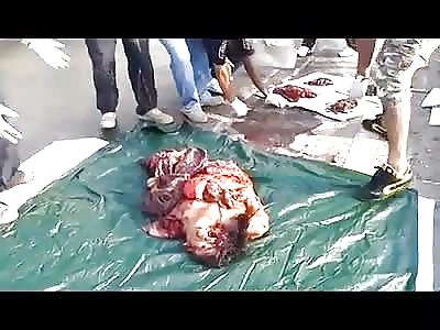 Body completely busted woman after accident