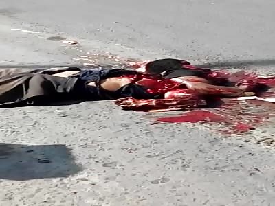 Pedestrian dies run over by a truck and left with exposed viscera