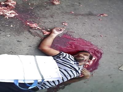 Dead man with brains scattered on the street