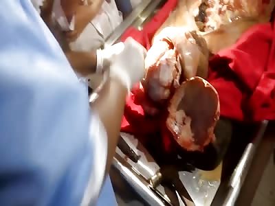 Brain extraction demonstration in medical school