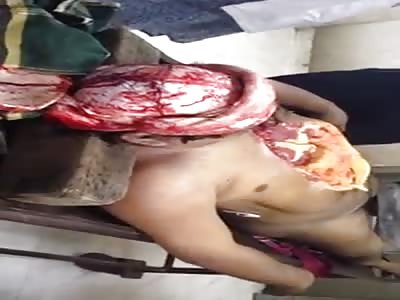 Necropsy of a suicidal man