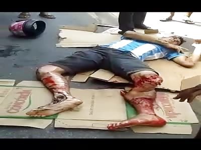 Argentine hit by truck outside the stadium after the game Argentina - Bolivia